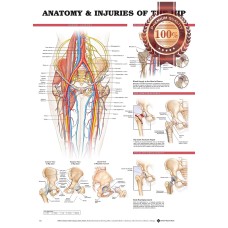 ANATOMY AND INJURIES OF THE HIPS DIAGRAM CHART GUIDE PRINT PREMIUM POSTER