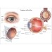 ANATOMICAL DIAGRAM HUMAN EYE ANATOMY OPTOMETRIST CHART PRINT PREMIUM POSTER