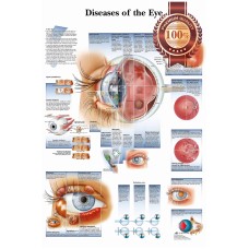 DISEASES OF THE HUMAN EYE INFOMATIONAL CHART DIAGRAM PRINT PREMIUM POSTER