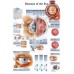 DISEASES OF THE HUMAN EYE INFOMATIONAL CHART DIAGRAM PRINT PREMIUM POSTER